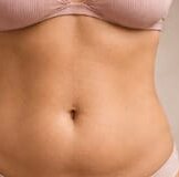Antes e depois de cliente da Glamour Estética Feminina
