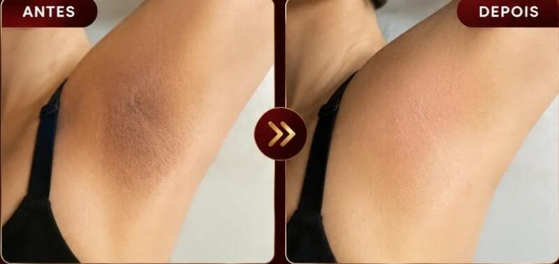Antes e depois de cliente da Glamour Estética Feminina