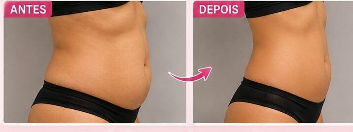 Antes e depois de cliente da Glamour Estética Feminina