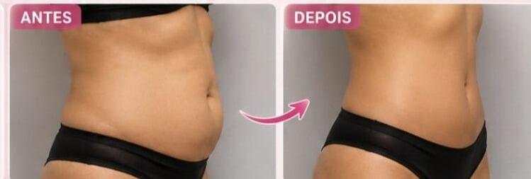 Antes e depois de cliente da Glamour Estética Feminina