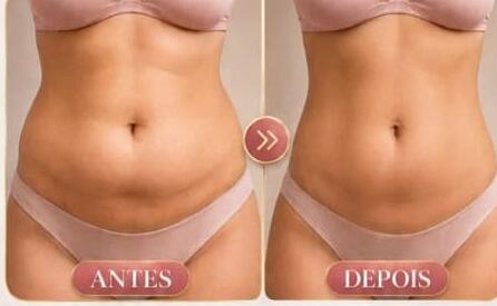 Antes e depois de cliente da Glamour Estética Feminina