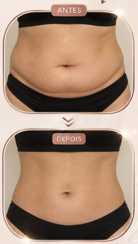 Antes e depois de cliente da Glamour Estética Feminina
