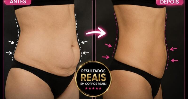 Antes e depois de cliente da Glamour Estética Feminina
