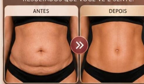 Antes e depois de cliente da Glamour Estética Feminina