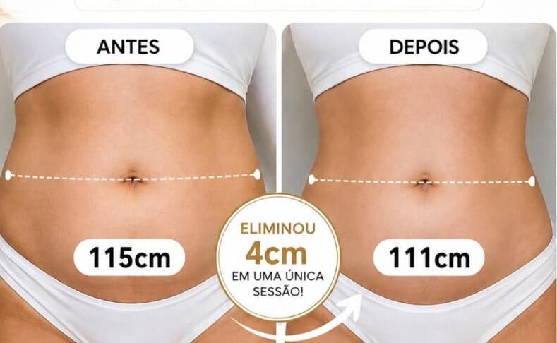 Antes e depois de cliente da Glamour Estética Feminina