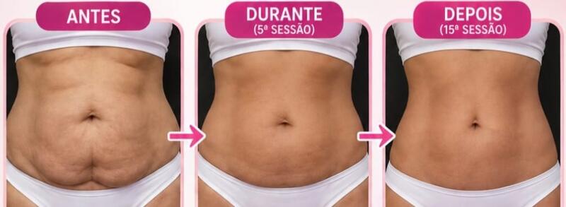 Antes e depois de cliente da Glamour Estética Feminina