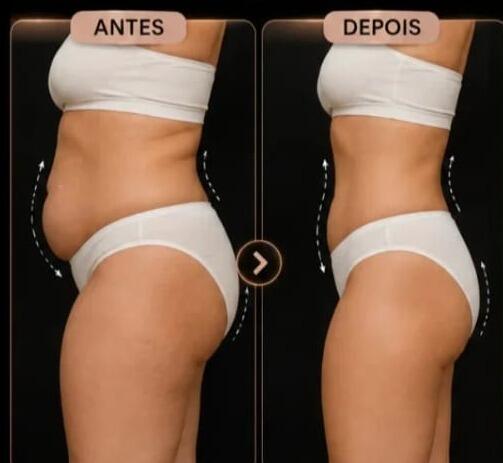 Antes e depois de cliente da Glamour Estética Feminina
