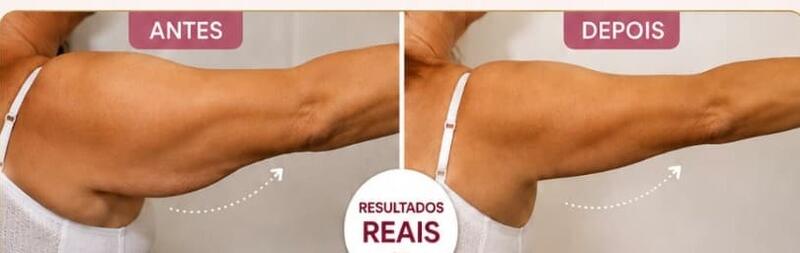 Antes e depois de cliente da Glamour Estética Feminina