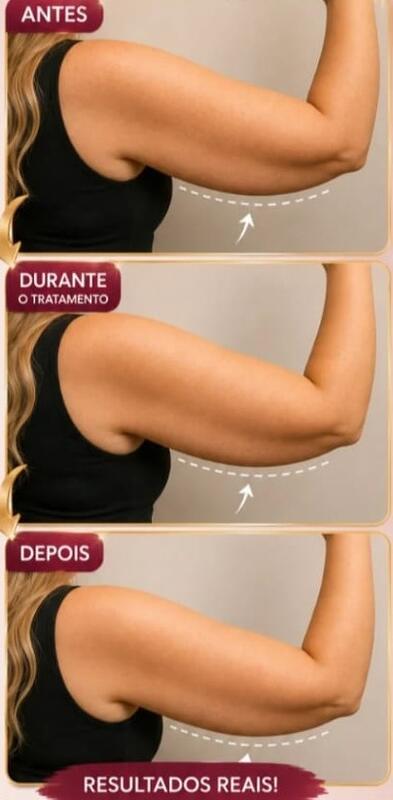 Antes e depois de cliente da Glamour Estética Feminina