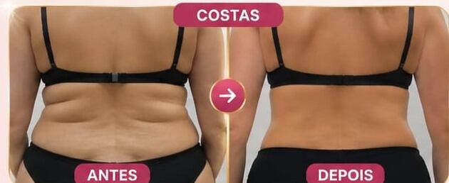 Antes e depois de cliente da Glamour Estética Feminina