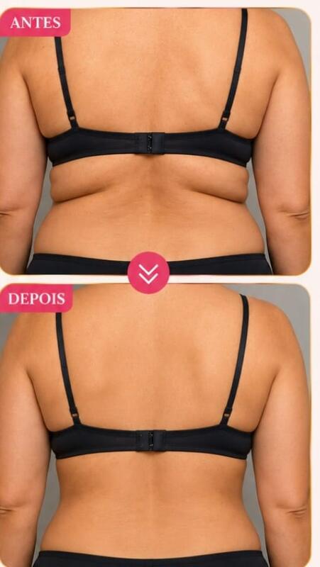 Antes e depois de cliente da Glamour Estética Feminina