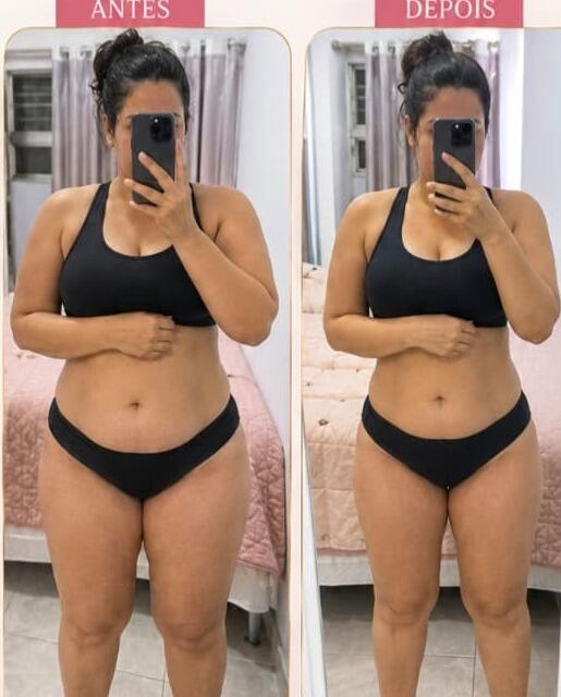 Antes e depois de cliente da Glamour Estética Feminina