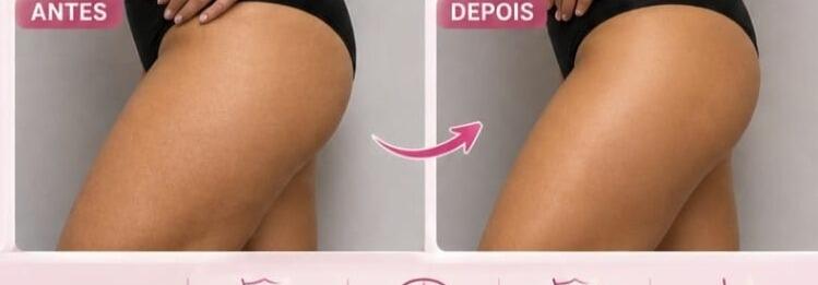 Antes e depois de cliente da Glamour Estética Feminina