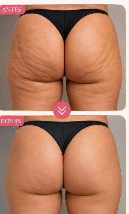 Antes e depois de cliente da Glamour Estética Feminina