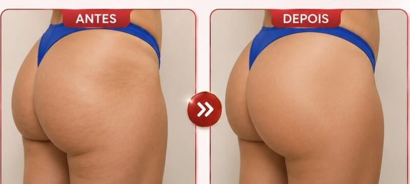 Antes e depois de cliente da Glamour Estética Feminina