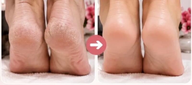Antes e depois de cliente da Glamour Estética Feminina